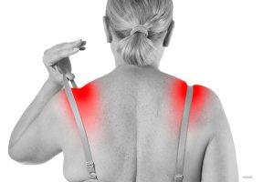 Woman pulling at bra strap. Red skin beneath to show pain.